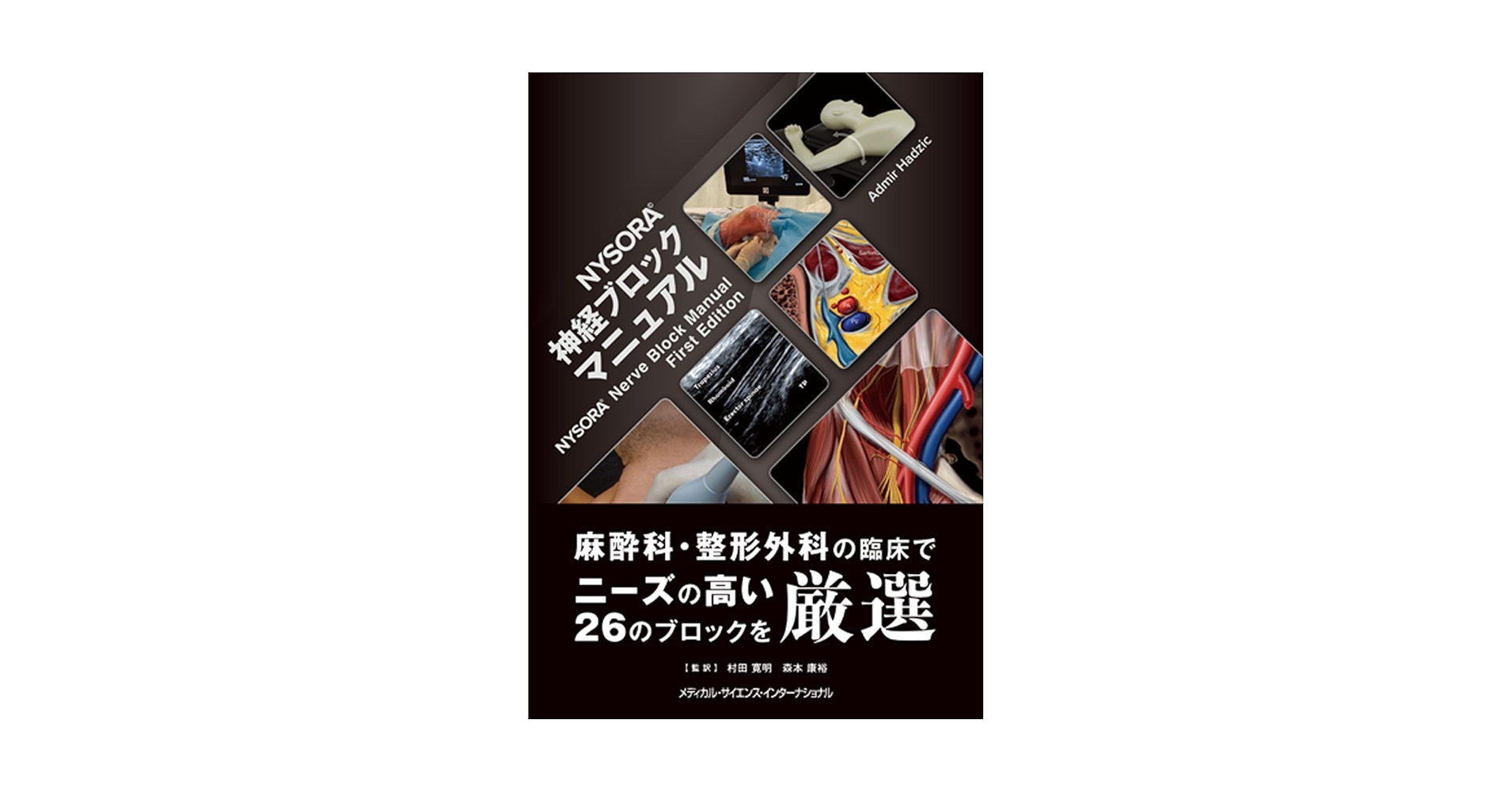 末梢神経ブロックカラーアトラス : 整形外科手術,ペインクリニックのために Amazon.co.jp: 末梢神経ブロックカラーアトラス―整形外科手術